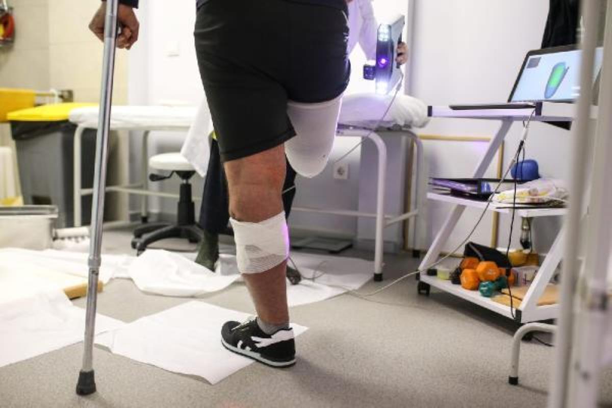 Sarsıntılarda yaşanan 1300 uzuv kaybına fiyatsız protez