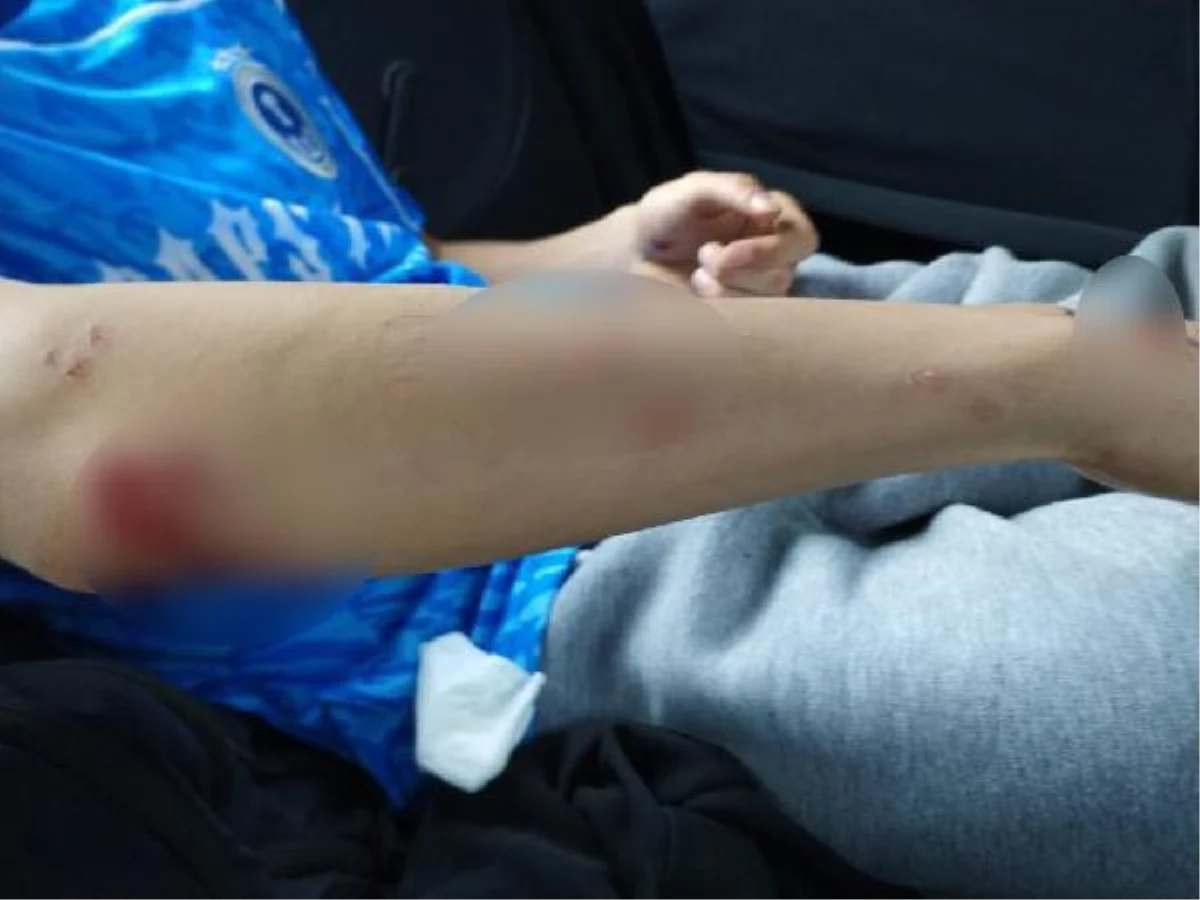Zonguldak'ta sokak köpekleri lise öğrencisine saldırdı